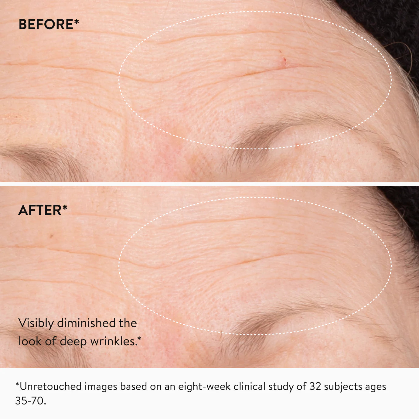 Retinol Regenerating Serum